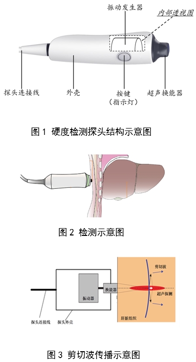 定量剪切波超聲肝臟測(cè)量?jī)x注冊(cè)審查指導(dǎo)原則(2023年第7號(hào))(圖2) 定量剪切波超聲肝臟測(cè)量?jī)x注冊(cè)審查指導(dǎo)原則(2023年第7號(hào))(圖2)